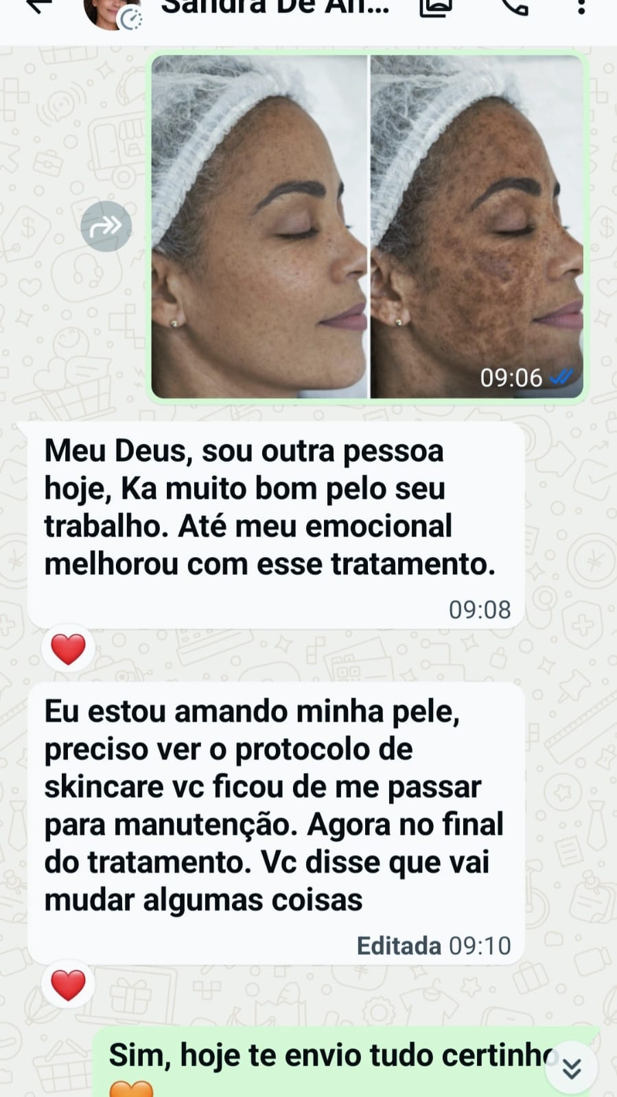 Depoimento